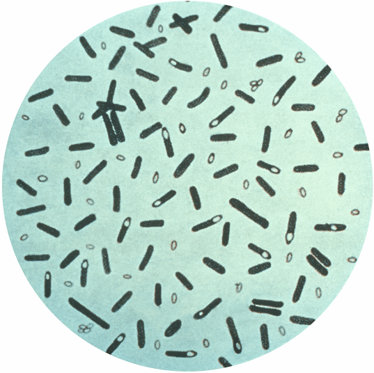 Clostridium_botulinum_01