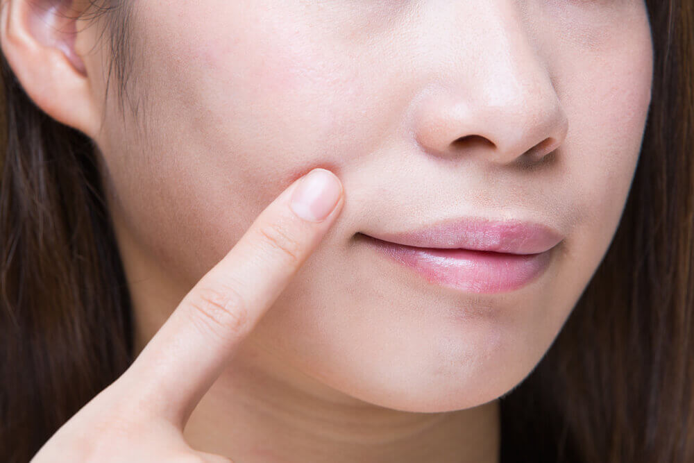 What-Causes-Nasolabial-Folds-to-Form