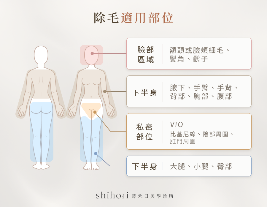 海神除毛適用部位