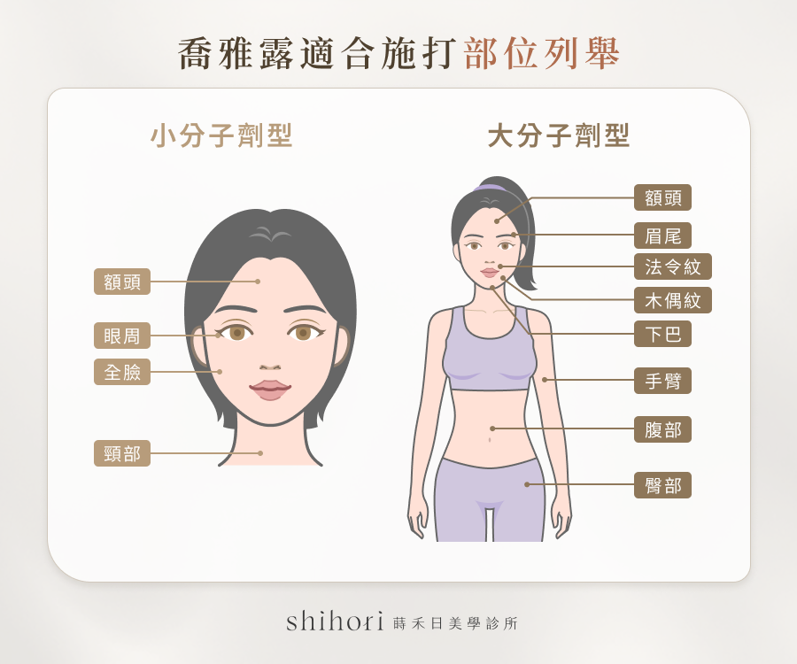 喬雅露適合施打部位列舉